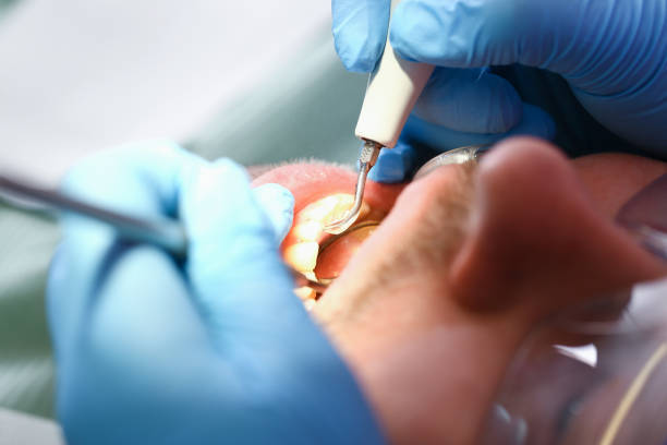 Best Cracked Tooth Emergency Dentist  in Wesley Chapel, FL