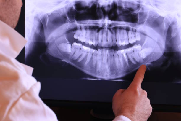 Best Teeth Whitening  in Wesley Chapel, FL